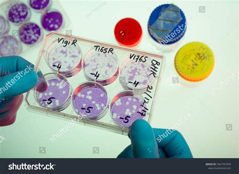 17 Plaque assay Images, Stock Photos & Vectors | Shutterstock