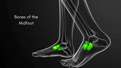 Midfoot Arthritis: Symptoms & Treatment by a Physical Therapist