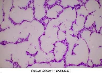 Spirillum Microscope Slide Royalty-Free Images, Stock Photos & Pictures | Shutterstock