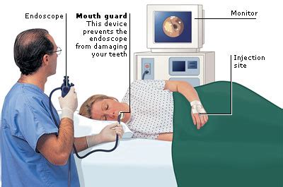 All You Need to Know About an Endoscopy | All To Health