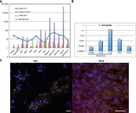 A Chimeric RNA Characteristic of Rhabdomyosarcoma in Normal Myogenesis Process | Cancer ...