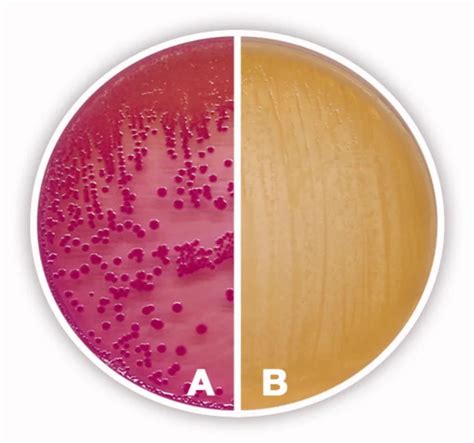 MacConkey Agar : Principle, Composition, Uses and Interpretation