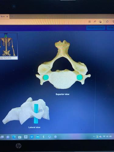 Upper Extremity - Bones Flashcards | Quizlet