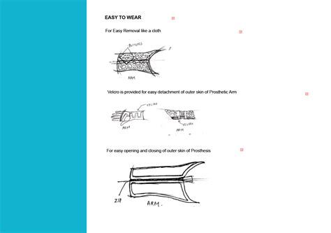 DESIGN OF PROSTHETIC ARM on Behance