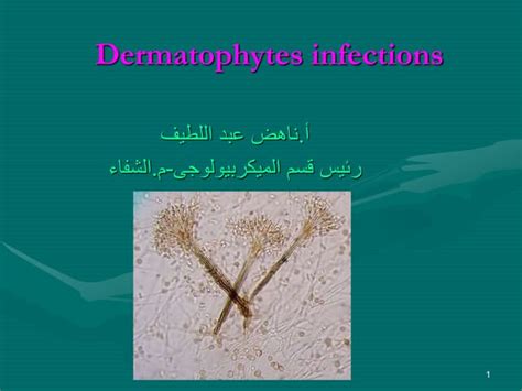 dermatophytes infections | PPT