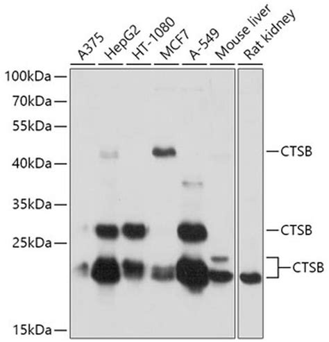 Anti-Cathepsin B Antibodies | Invitrogen