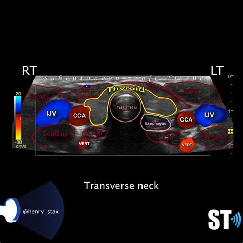 Desain Bendera Ultrasound Of Thyroid - IMAGESEE