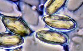 Microsporidia Infection