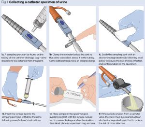 Catheter Urine Sample Collection Procedure for NMC OSCE Exam - OSCE Trainer