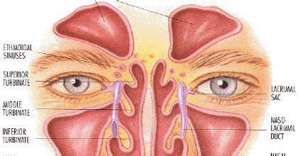 Blogging About Cystic Fibrosis (CF): Understanding Chronic Sinusitis