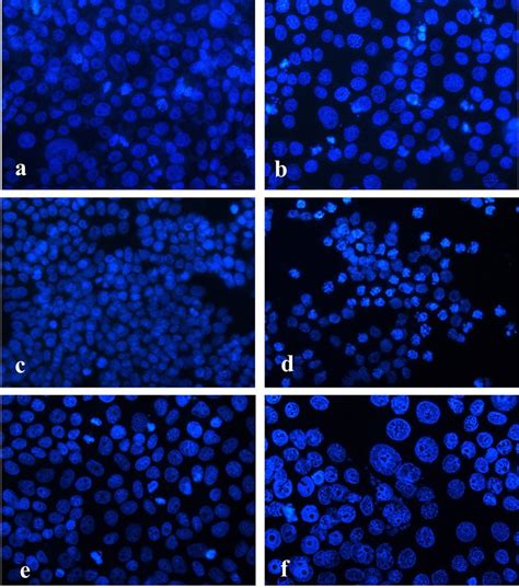 Fluorescence microscopy of Dapi stained human tumour cells after 24-h... | Download Scientific ...