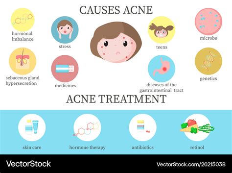 Acne causes and treatment diagram flat Royalty Free Vector