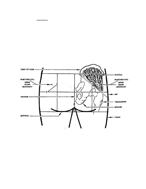 Figure 2-1. Intramuscular injection site in the buttocks (upper, outer ...