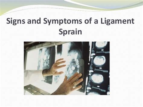 Signs and Symptoms of a Ligament Sprain