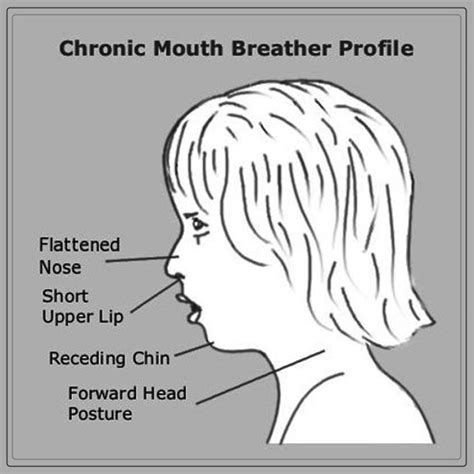 Mouth Breathing: Symptoms and Causes - Dentist Ahmed : Official Website