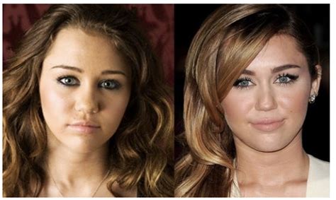 Miley Cyrus closeup face before and after - Latest Plastic Surgery ...