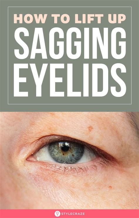 How To Lift Up Sagging Eyelids | Sagging eyelids, Saggy eyelids, Natural skin tightening