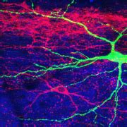 Surprising New Roles for Spinal Cord, Brainstem in Touch | Harvard ...