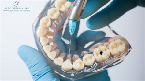 The Different Types of Dental Anesthesia