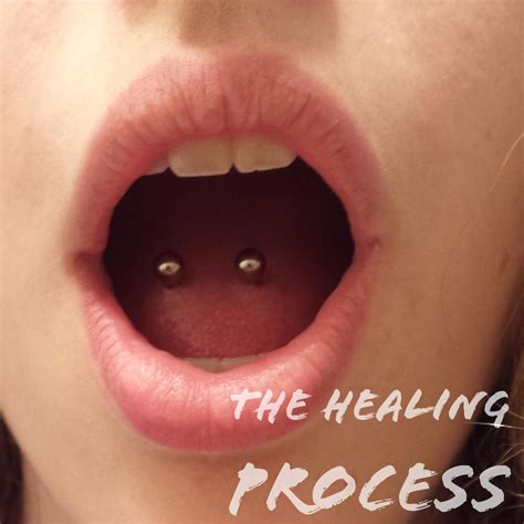 The Healing Process of a Tongue Piercing (With Pictures) - TatRing