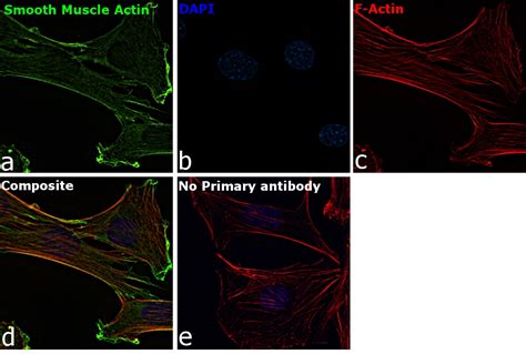 Alpha-Smooth Muscle Actin Antibody (14-9760-82)