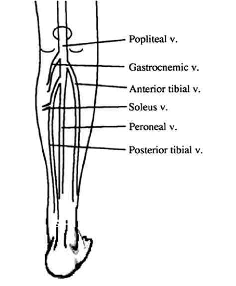 Gastrocnemius Soleal Vein