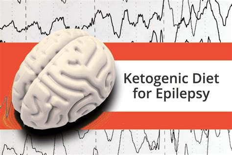 Ketogenic Diet for Epilepsy » Keto Certified