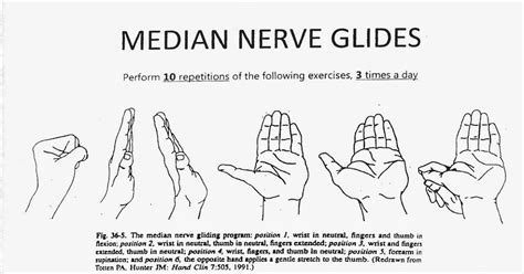 Manual Median Nerve Glides