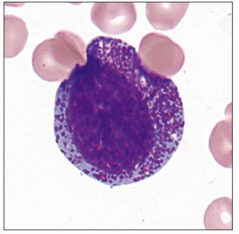 Promyelocyte (center) with azurophilic granules in the cytoplasm; the ...