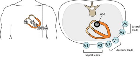 The ECG leads: electrodes, limb leads, chest (precordial) leads, 12-Lead ECG (EKG) – ECG learning