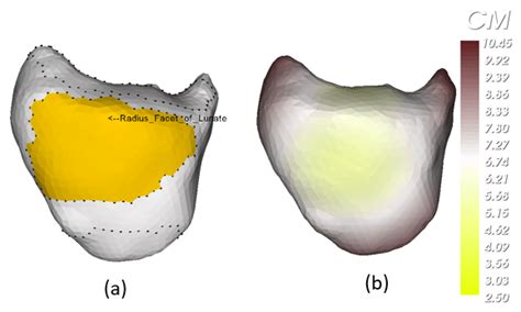 29: Lunate bone of Patient 5 1: (a) annotated Radius facets of Lunate;... | Download Scientific ...