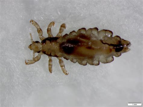 Head lice | UMN Extension