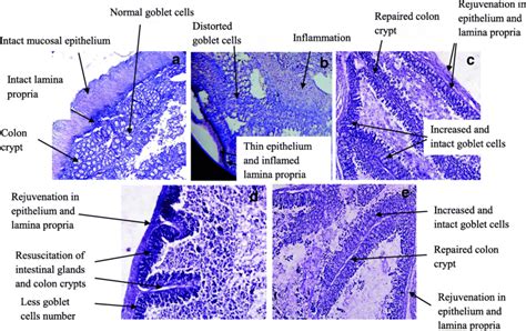 Large Intestine Histology Slides