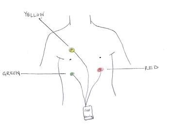 Nursing Guidelines : Holter monitor management