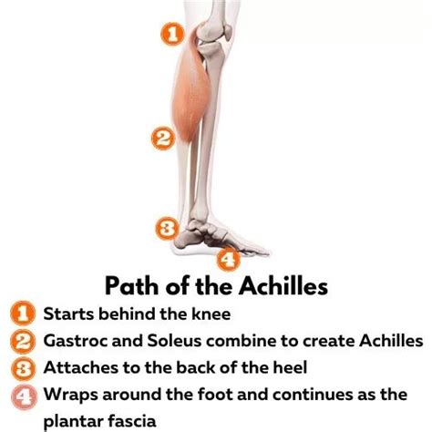 What to Know: Gastrocnemius Recession for Plantar Fasciitis