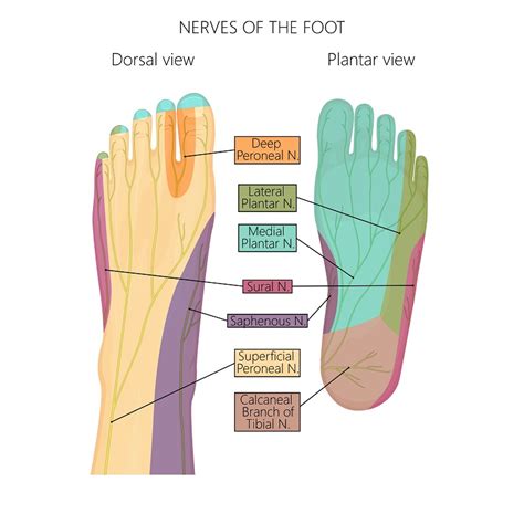 Nerve Entrapments - Plantar Fascia Institute of MN