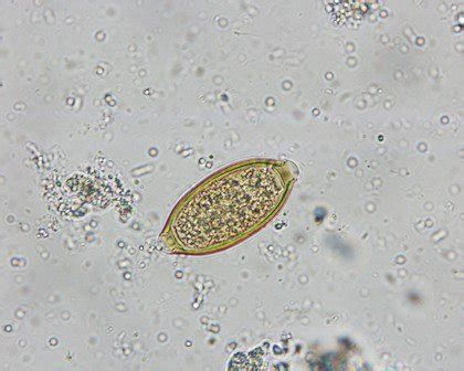 Parasites In Stool