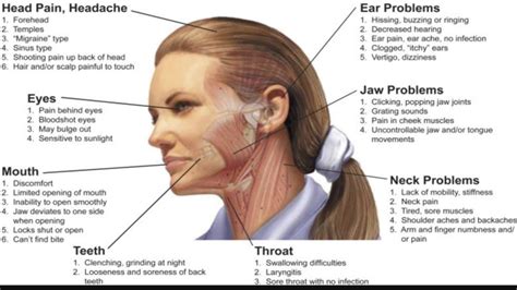 Headache in The Head - Symptom and Pain of Headache Anywhere in Head - YouTube