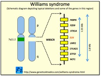 Causes, Detection, and Diagnosis - Williams Syndrome