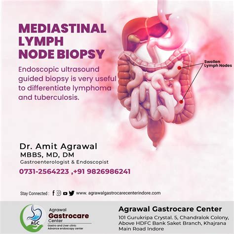 Mediastinal Lymph Node Biopsy - Agrawal Gastrocare Center Indore