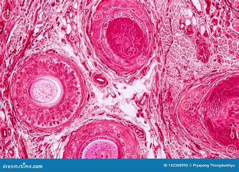 Elastic Cartilage Histology Ear