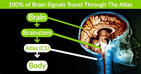 What is The Atlas Bone? | Family Health Chiropractic