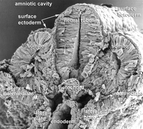 Notochord - Embryology