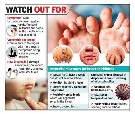 Paediatricians witnessing drastic increase in hand-foot-and-mouth ...