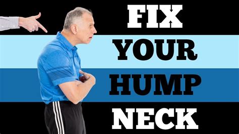 The most effective exercises to correct 'neck hump' | Cyprus Mail