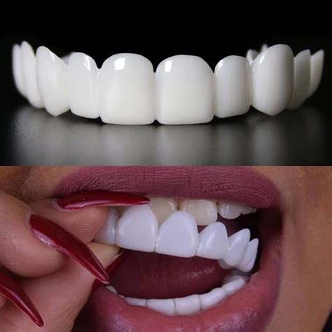 Dental Veneers Abu Dhabi | AQMC