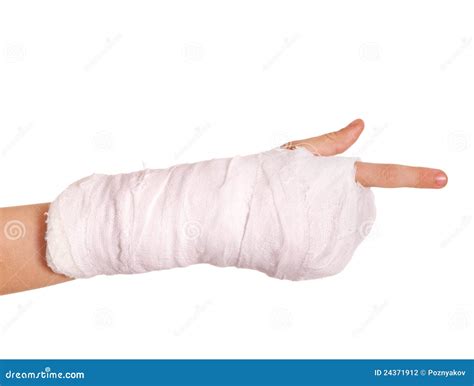 Broken Arm In A Cast Stock Photography - Image: 24371912