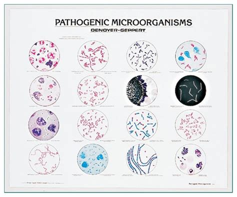 Pathogenic Microorganisms Chart Pathogenic microorganisms:Education Supplies, | Fisher Scientific