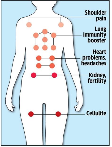 7 Health Benefits of Cupping Therapy