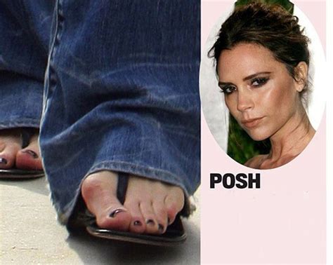 Celebrities with Ugly Feet (15 pics)